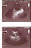 Ultrasound A 04 05 01.jpg (73524 bytes)